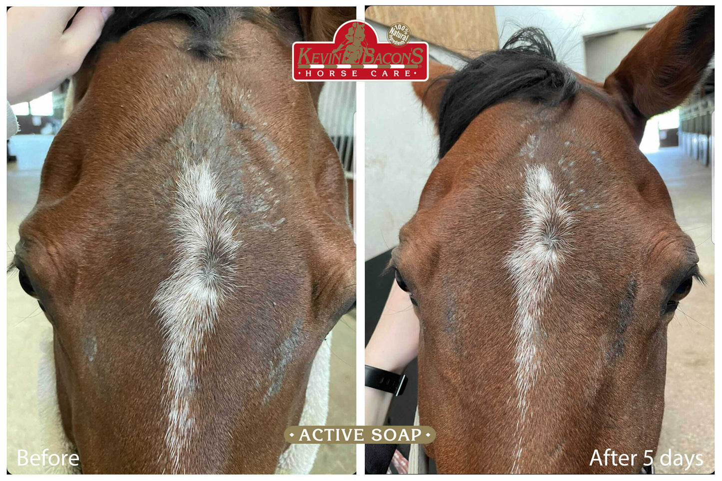 Jabón anti-picazón Kevin Bacon's